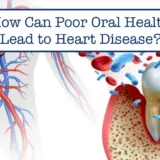 poor oral health